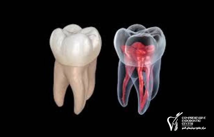 پیشگیری و مراقبت از ریشه دندان